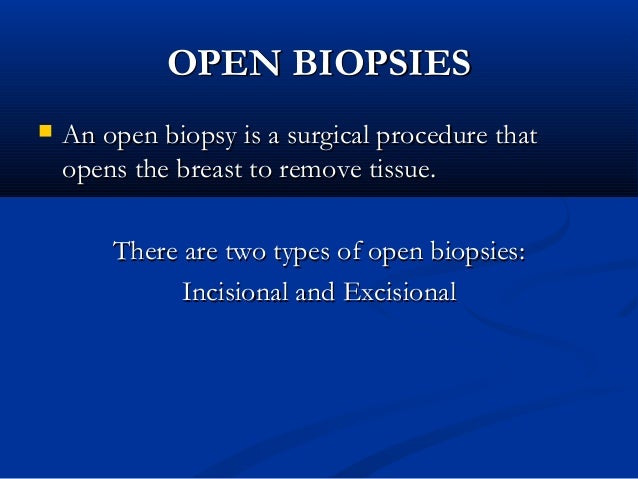 breast cancer biopsy types Sex and lucia pics